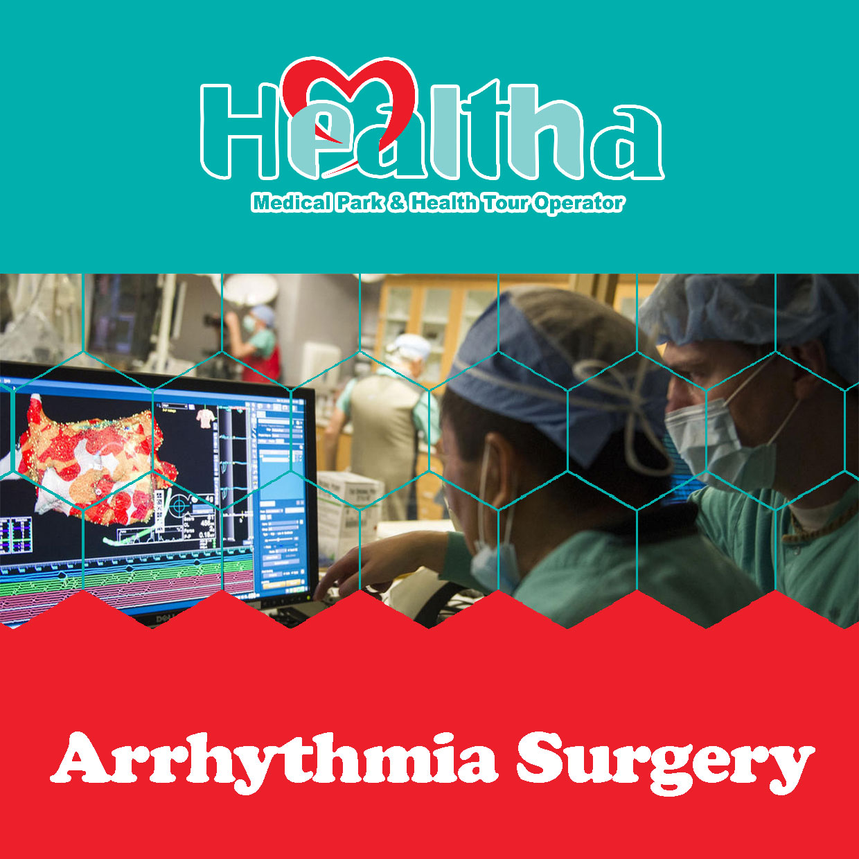 Arrhythmia Surgery Packages Healtha Medical Tourism In Iran