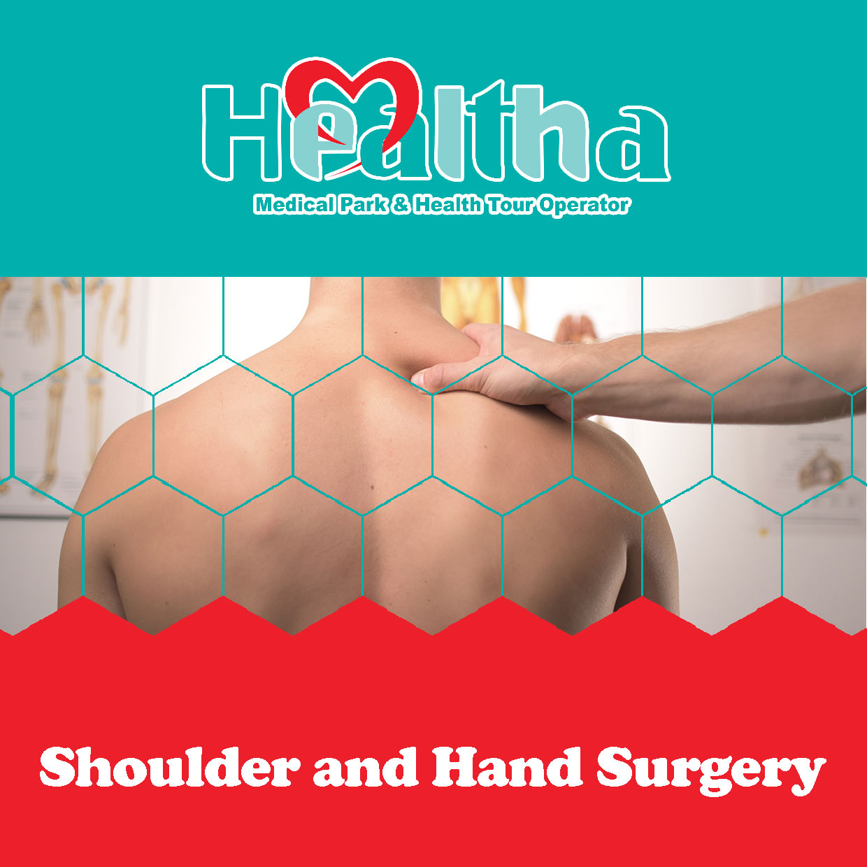 shoulder-and-hand-surgery-healtha-medical-tourism-in-iran