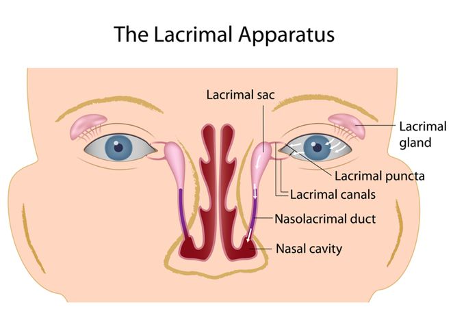 Lacrimal duct surgery in Iran
