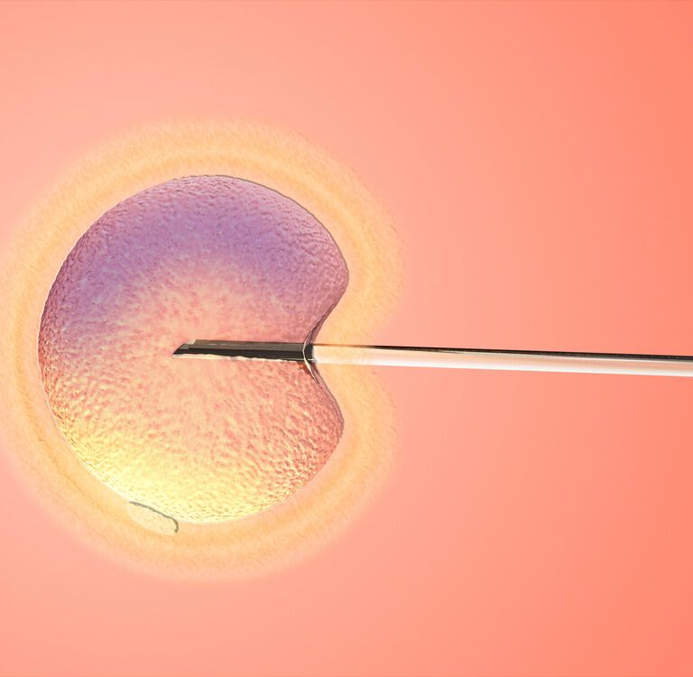 treatment of infertility with IVF