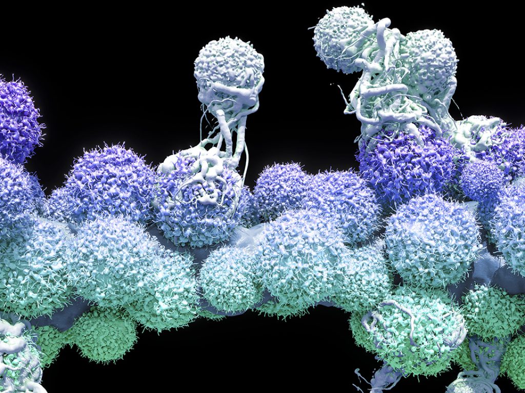 T cells attacking cancer cells. 3D computer illustration of T lymphocyte white blood cells (white) destroying cancerous cells (blue/green). T lymphocytes, or T cells, are a type of white blood cell and a component of the body's immune system. They recognise a specific site on the surface of a pathogen or foreign object (antigen), bind to it, and produce antibodies or cells to eliminate it.